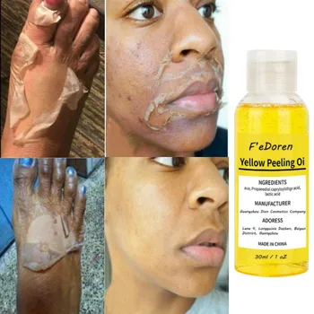 Жълто отшелушивающее масло е подходящ за по-тъмна кожа. Силно отшелушивающее масло избелва кожата, хидратира и изсветлява меланин