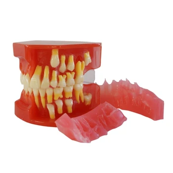 Модел на зъбите с 28 подвижни зъби, обучение за възстановяване за училище