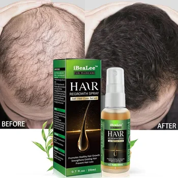 Средство за растеж на косата с джинджифил, етерично масло за бърз растеж на косата, Козметични грижа за косата, което предотвратява загубата на коса, масло за грижа за кожата на главата за мъже и жени Средство за растеж на косата с джинджифил, етерично масло за бърз растеж на косата, Козметични грижа за косата, което предотвратява загубата на коса, масло за грижа за кожата на главата за мъже и жени 0