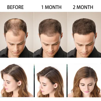 Средство за растеж на косата с джинджифил, етерично масло за бърз растеж на косата, Козметични грижа за косата, което предотвратява загубата на коса, масло за грижа за кожата на главата за мъже и жени Средство за растеж на косата с джинджифил, етерично масло за бърз растеж на косата, Козметични грижа за косата, което предотвратява загубата на коса, масло за грижа за кожата на главата за мъже и жени 2