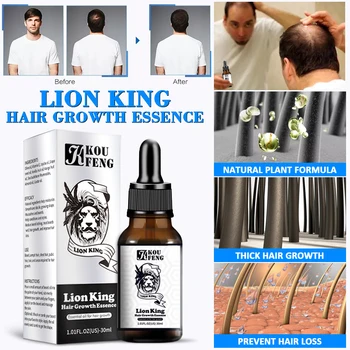Масло за бърз растеж на косата, серум за растеж на косата, лекарство за лечение на фоликули от косопад, масло за гъст растеж на косата за мъже и жени за възстановяване на косата Масло за бърз растеж на косата, серум за растеж на косата, лекарство за лечение на фоликули от косопад, масло за гъст растеж на косата за мъже и жени за възстановяване на косата 3